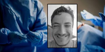 Joven se quita la vida tras fallido trasplante de barba hecho por un falso cirujano