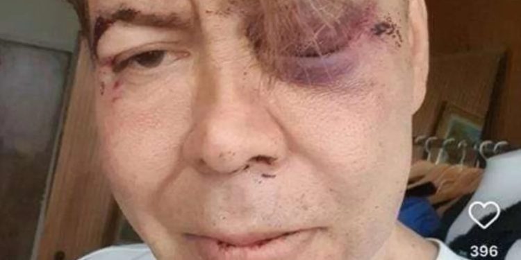 Muere reconocido diseñador tras recibir golpiza; tres vigilantes de un centro comercial lo habría agredido