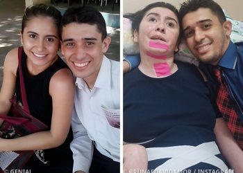 Enamorado esposo renunció a su vida para dedicarse a su esposa que quedó en estado vegetal