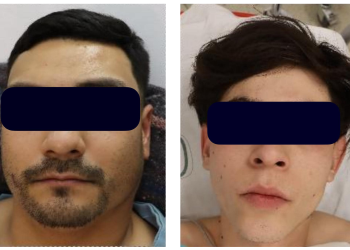 Vinculan a proceso sujetos que se atacaron a balazos a elementos de la Policìa Estatal a la altura del Cerro de la Virgen