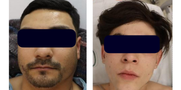 Vinculan a proceso sujetos que se atacaron a balazos a elementos de la Policìa Estatal a la altura del Cerro de la Virgen