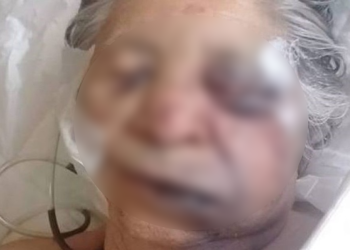 Tras golpear a su mamá de 83 años de edad, Javier “N” fue presentado ante la autoridad investigadora.