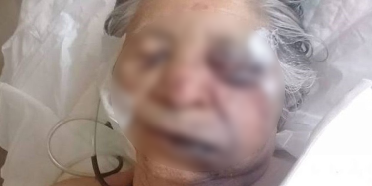 Tras golpear a su mamá de 83 años de edad, Javier “N” fue presentado ante la autoridad investigadora.