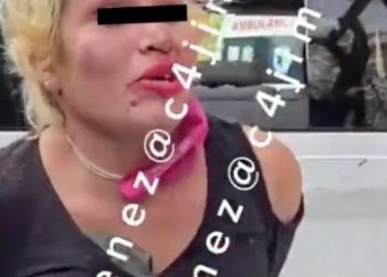 A mordidas, mujer arranca dedos a hombre y policía tras intento de asalto en Iztacalco