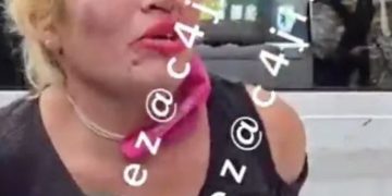 A mordidas, mujer arranca dedos a hombre y policía tras intento de asalto en Iztacalco