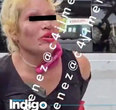 A mordidas, mujer arranca dedos a hombre y policía tras intento de asalto en Iztacalco